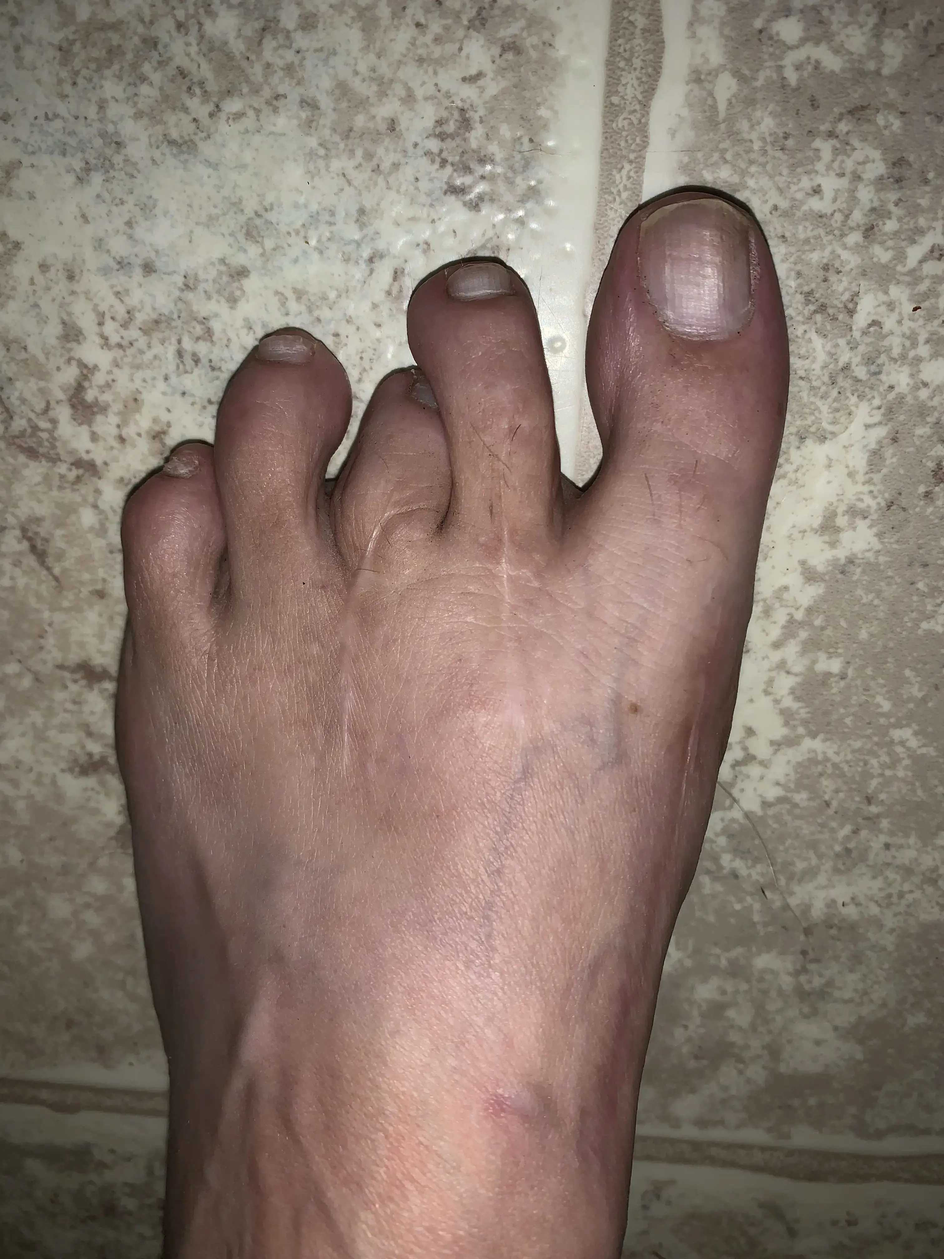 Advanced Foot & Ankle photo 5
