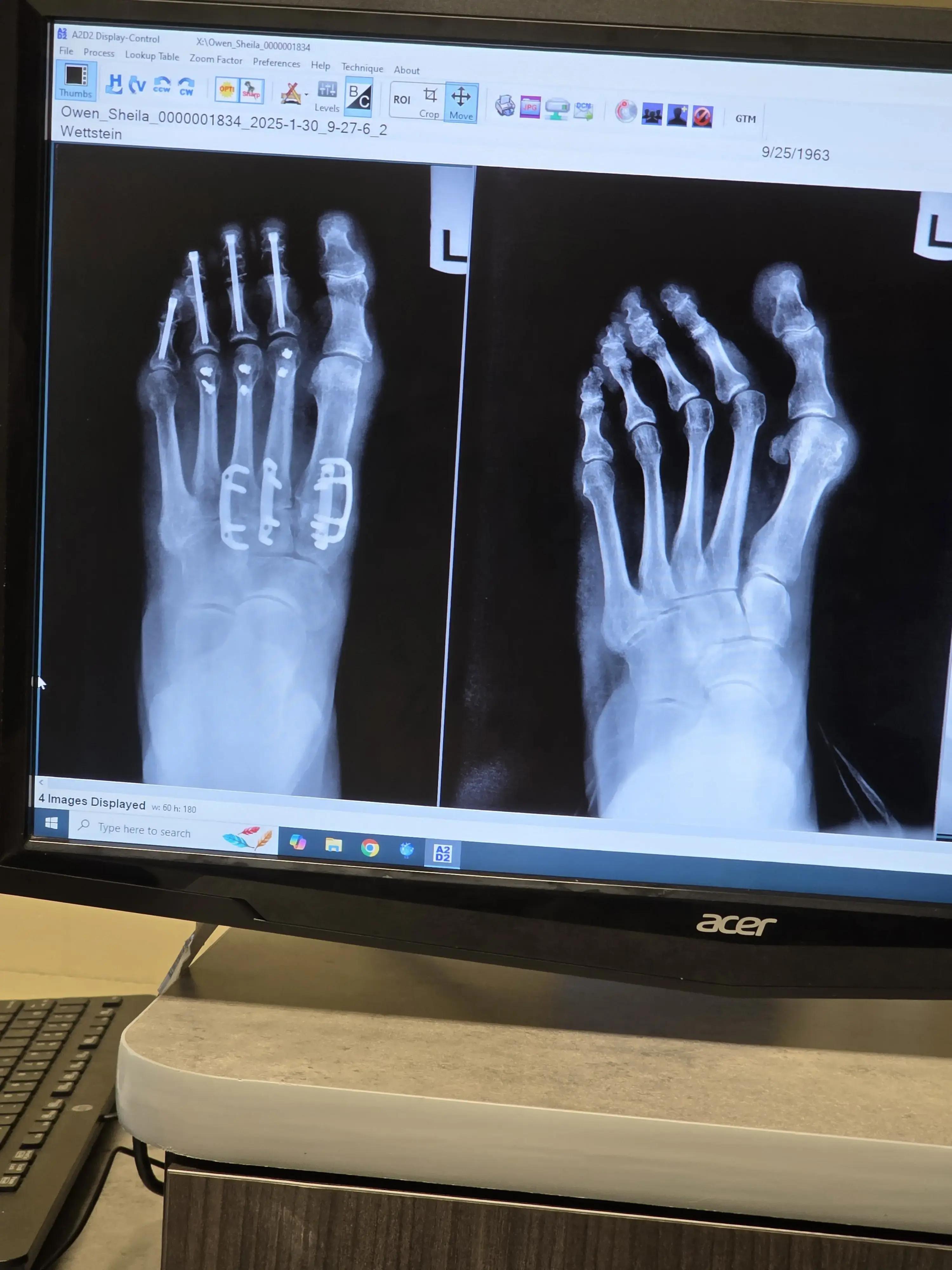 Advanced Foot & Ankle photo 3