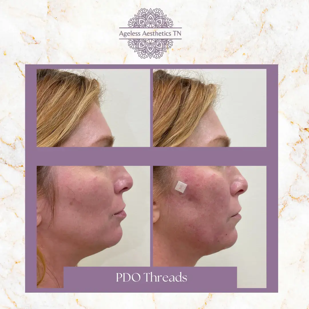 Ageless Aesthetics photo 5