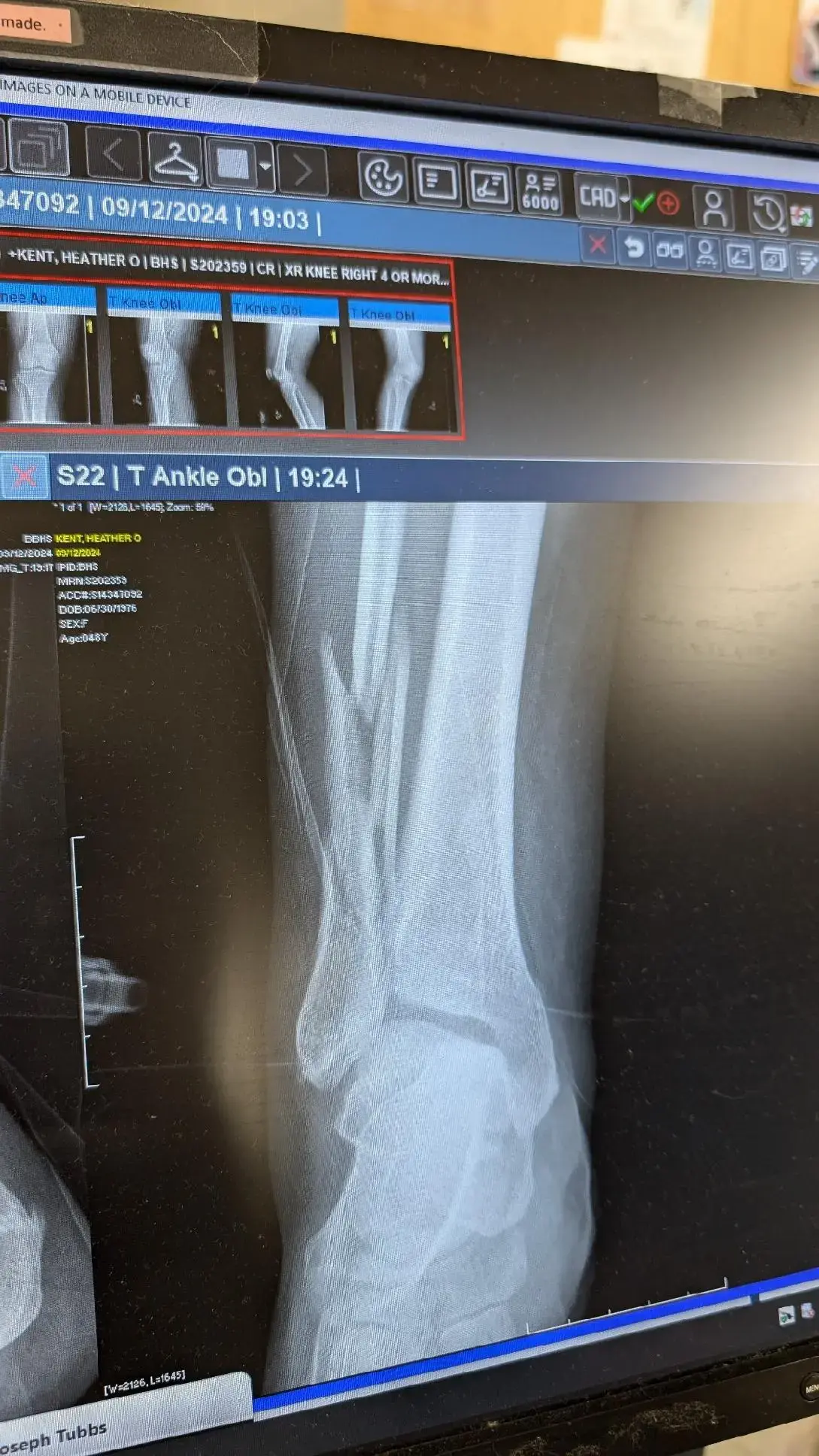 Alabama Bone & Joint Clinic photo 5