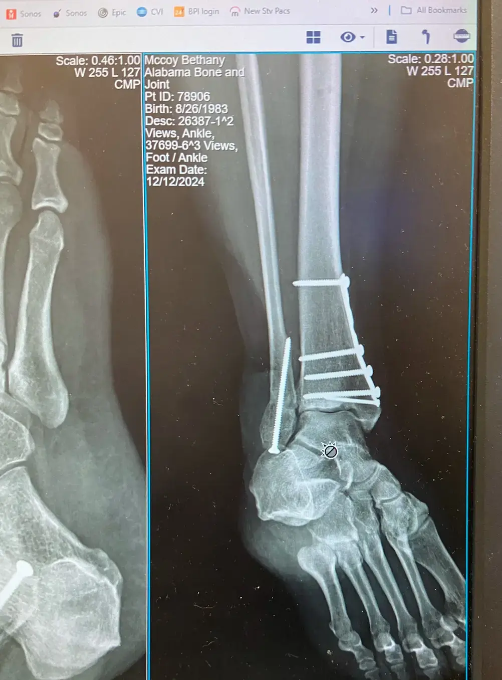 Alabama Bone & Joint Clinic photo 2