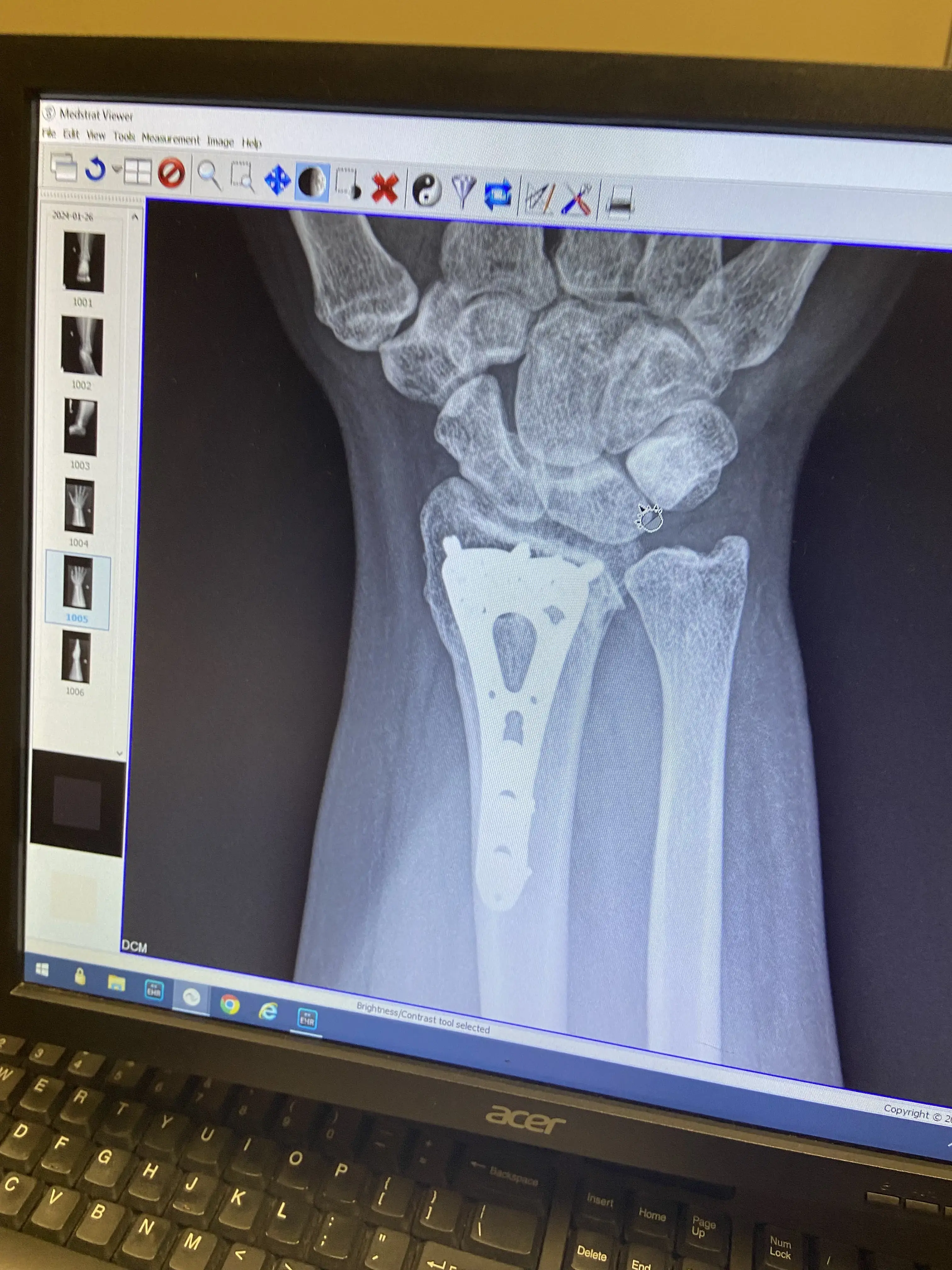 Alabama Bone & Joint Clinic photo 3