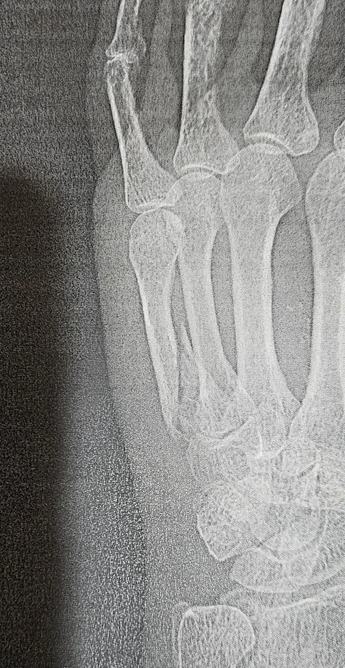 AOA Now Orthopedic Immediate Care photo 4