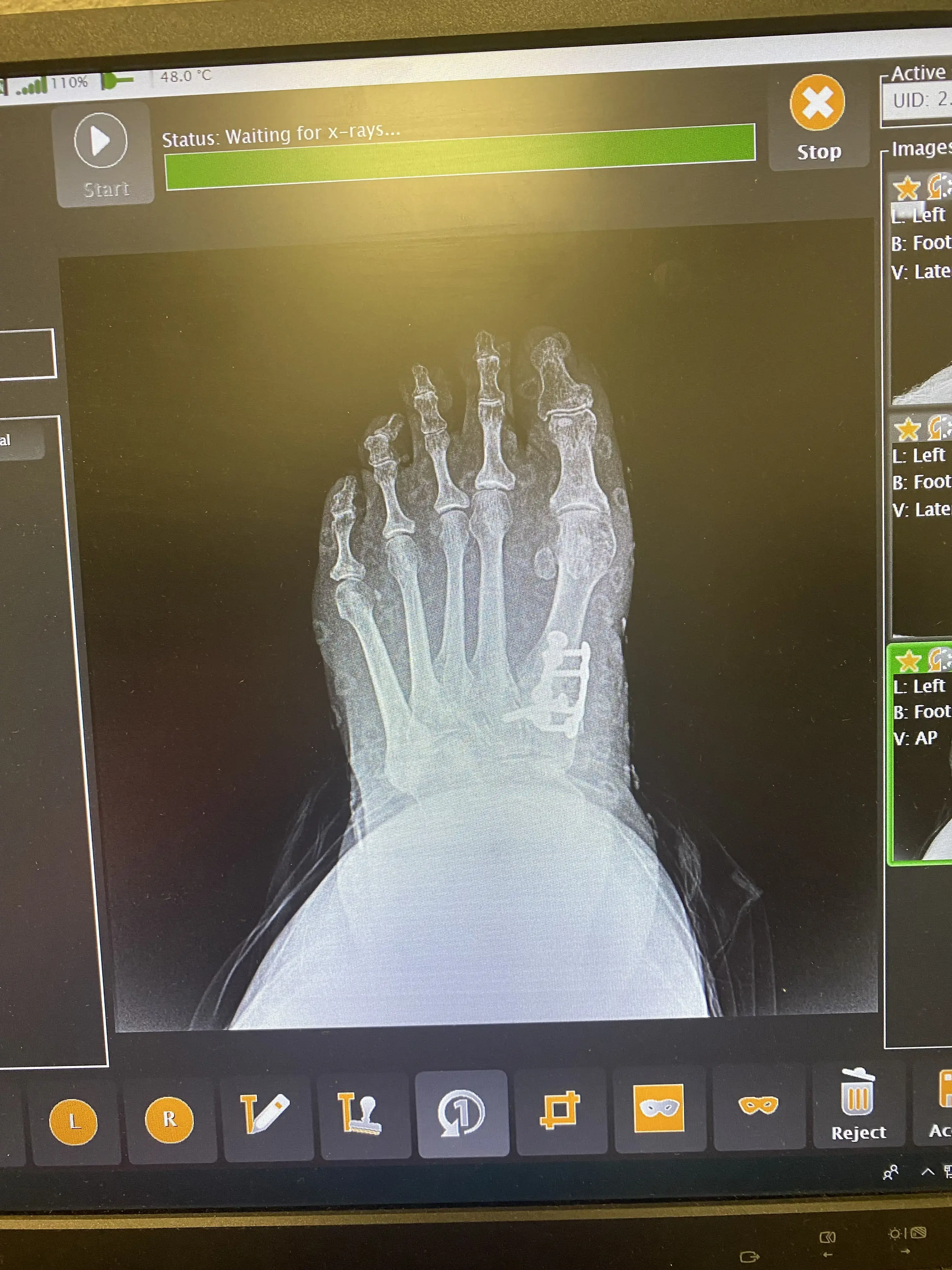 AZ Choice Foot and Ankle: Christopher Suykerbuyk, DPM photo 5