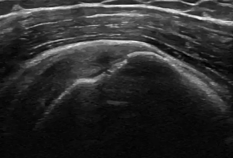 Brian Peternell, D.O. photo 3