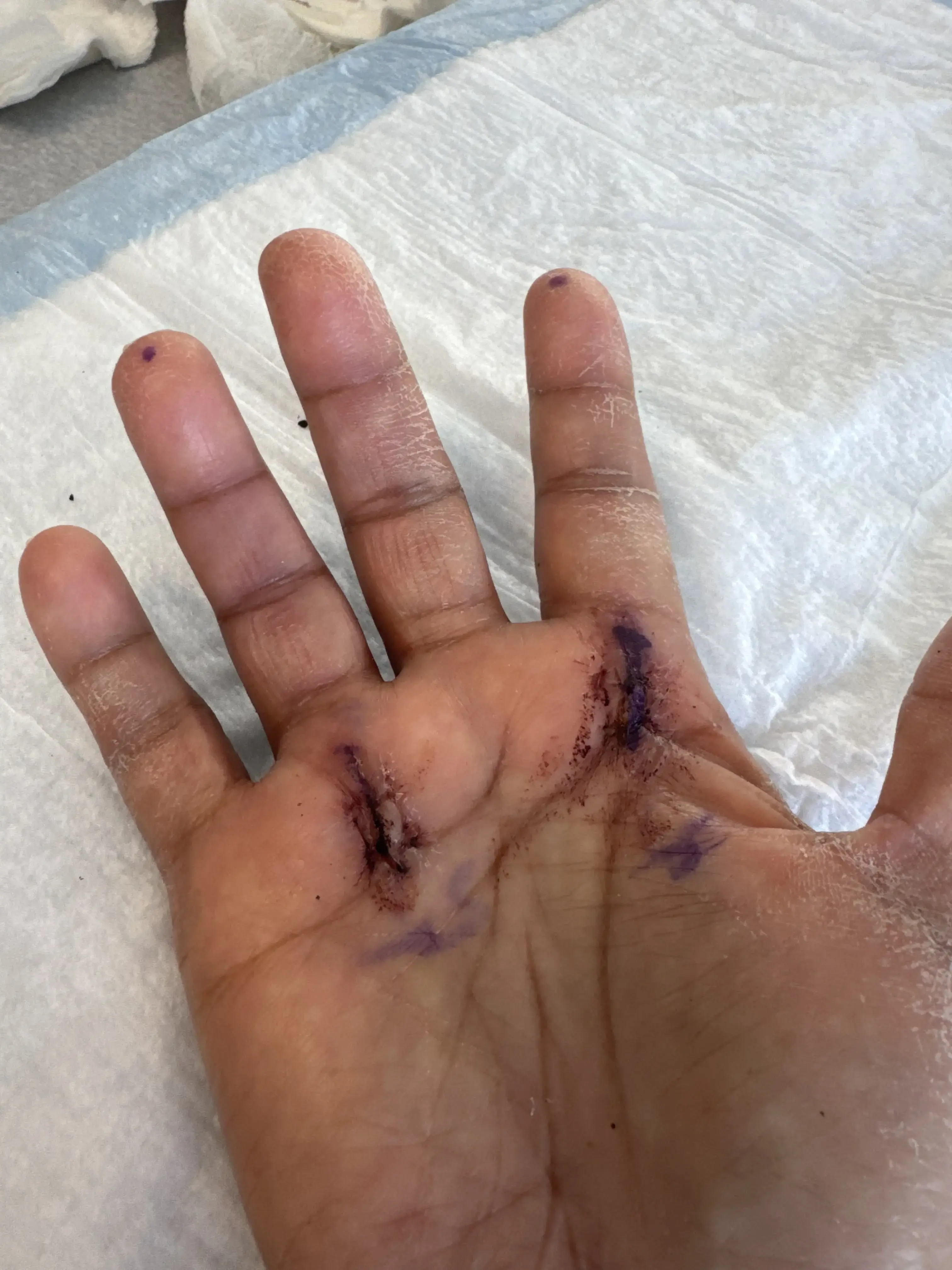 CAO The Centers for Advanced Orthopedics Manassas | Orthopedic Surgery, Podiatry, Pain Management & Physical Therapy photo 4