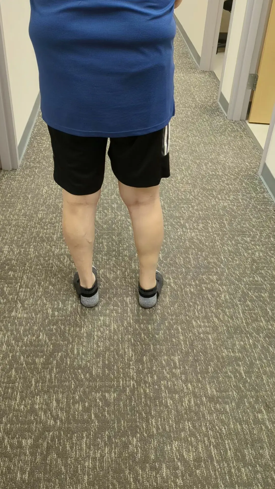 CAO The Centers for Advanced Orthopedics Manassas | Orthopedic Surgery, Podiatry, Pain Management & Physical Therapy photo 3