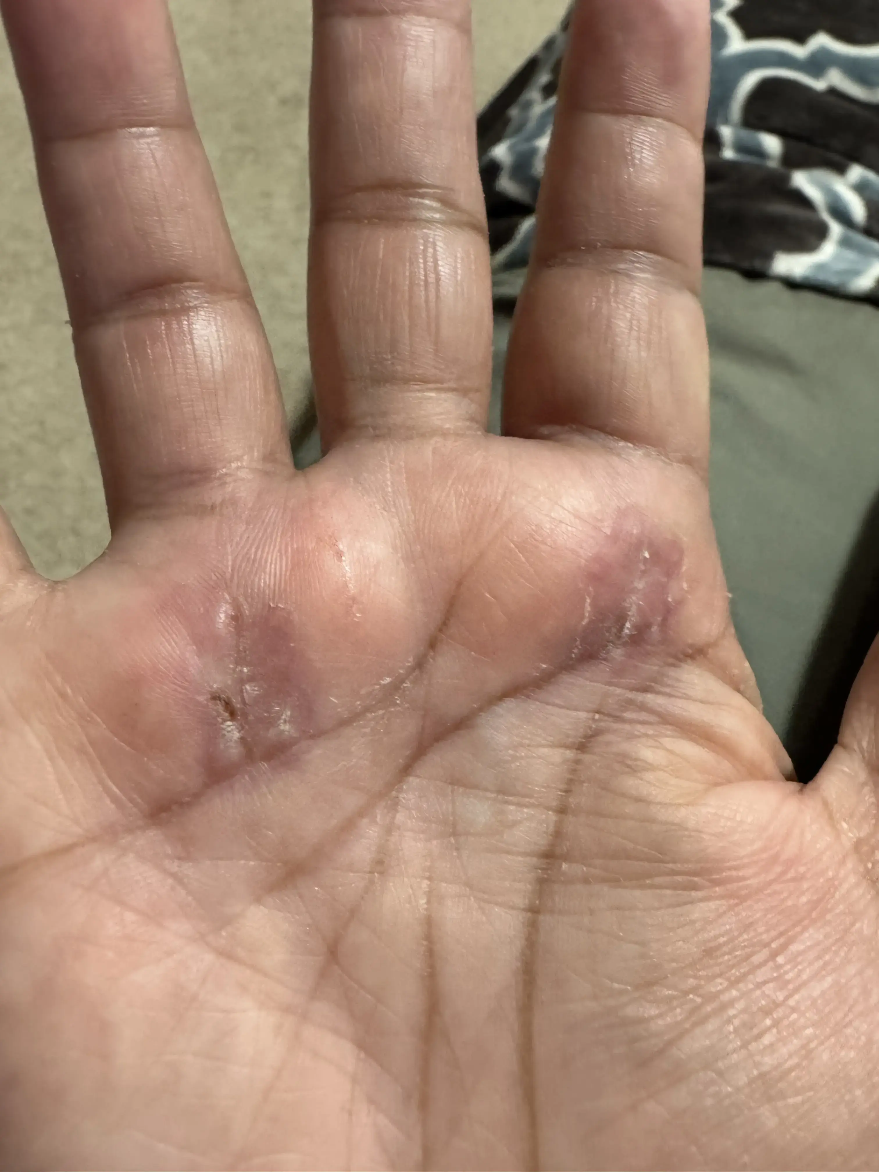 CAO The Centers for Advanced Orthopedics Manassas | Orthopedic Surgery, Podiatry, Pain Management & Physical Therapy photo 2