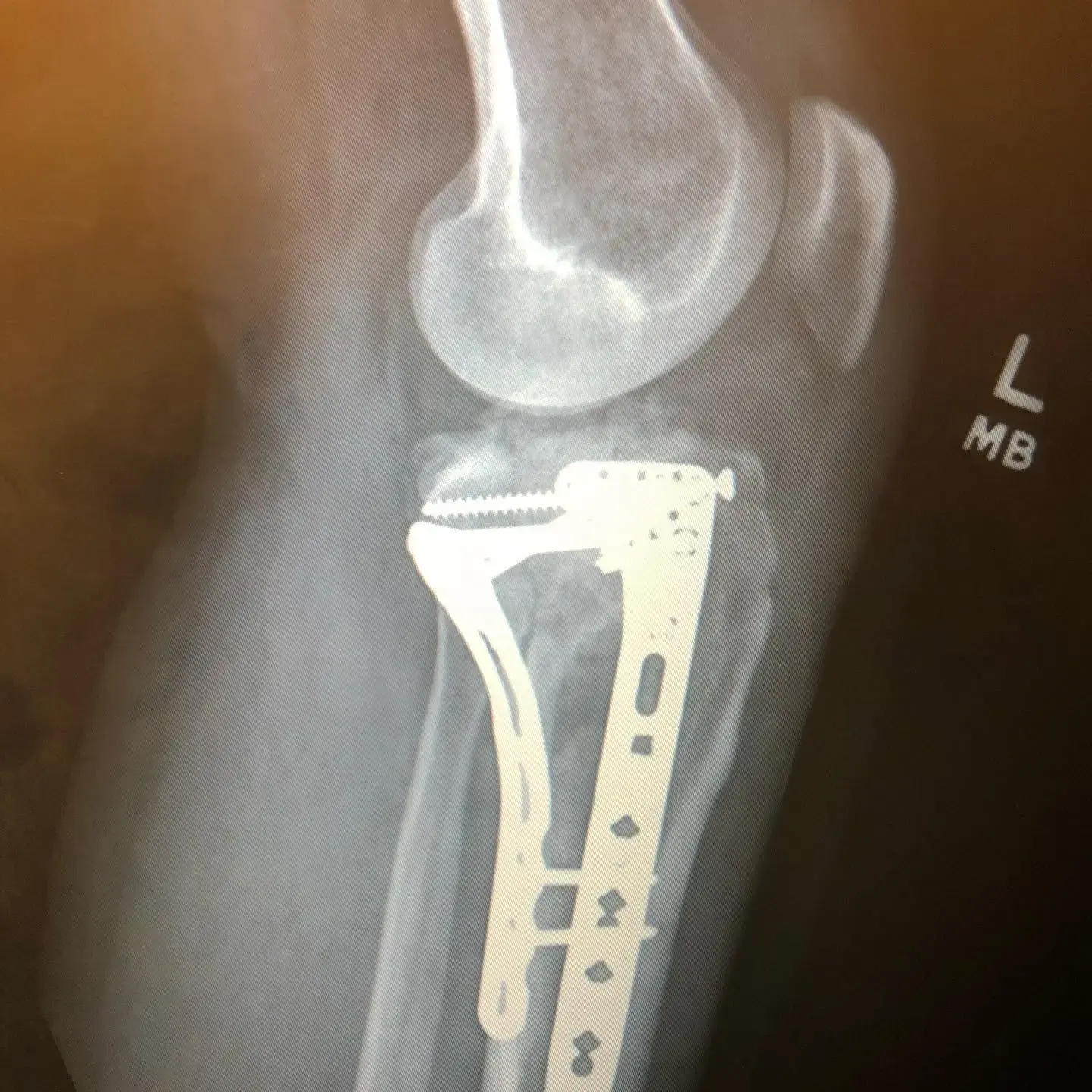 Christopher E Birch, M.D. photo 5