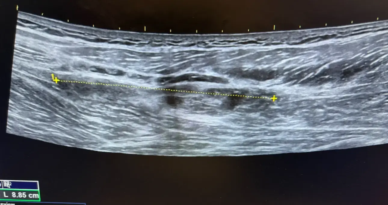 Erek W Latzka, MD photo 5