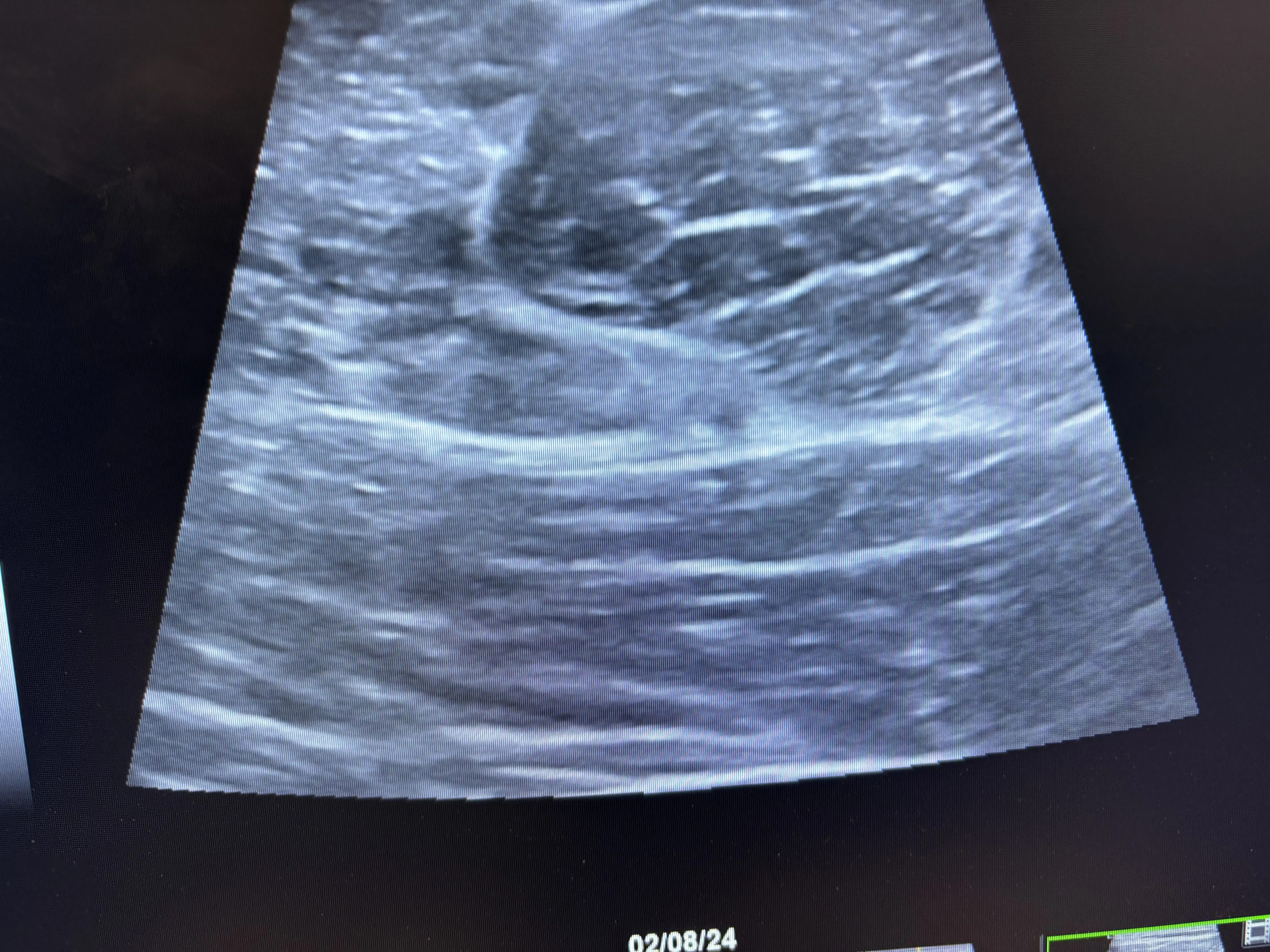 Erek W Latzka, MD photo 4