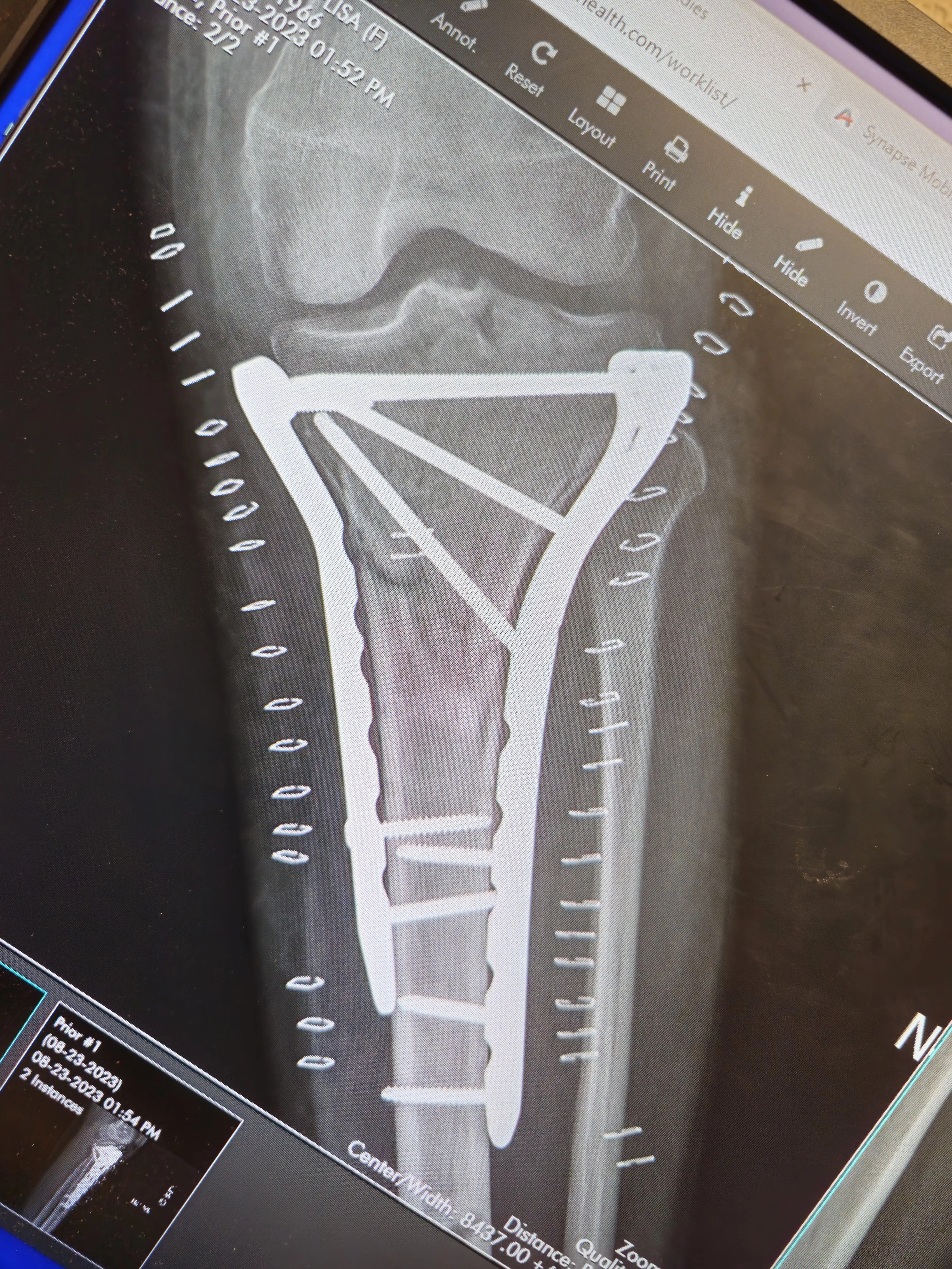 Jonathan Kletter, PA-C photo 2