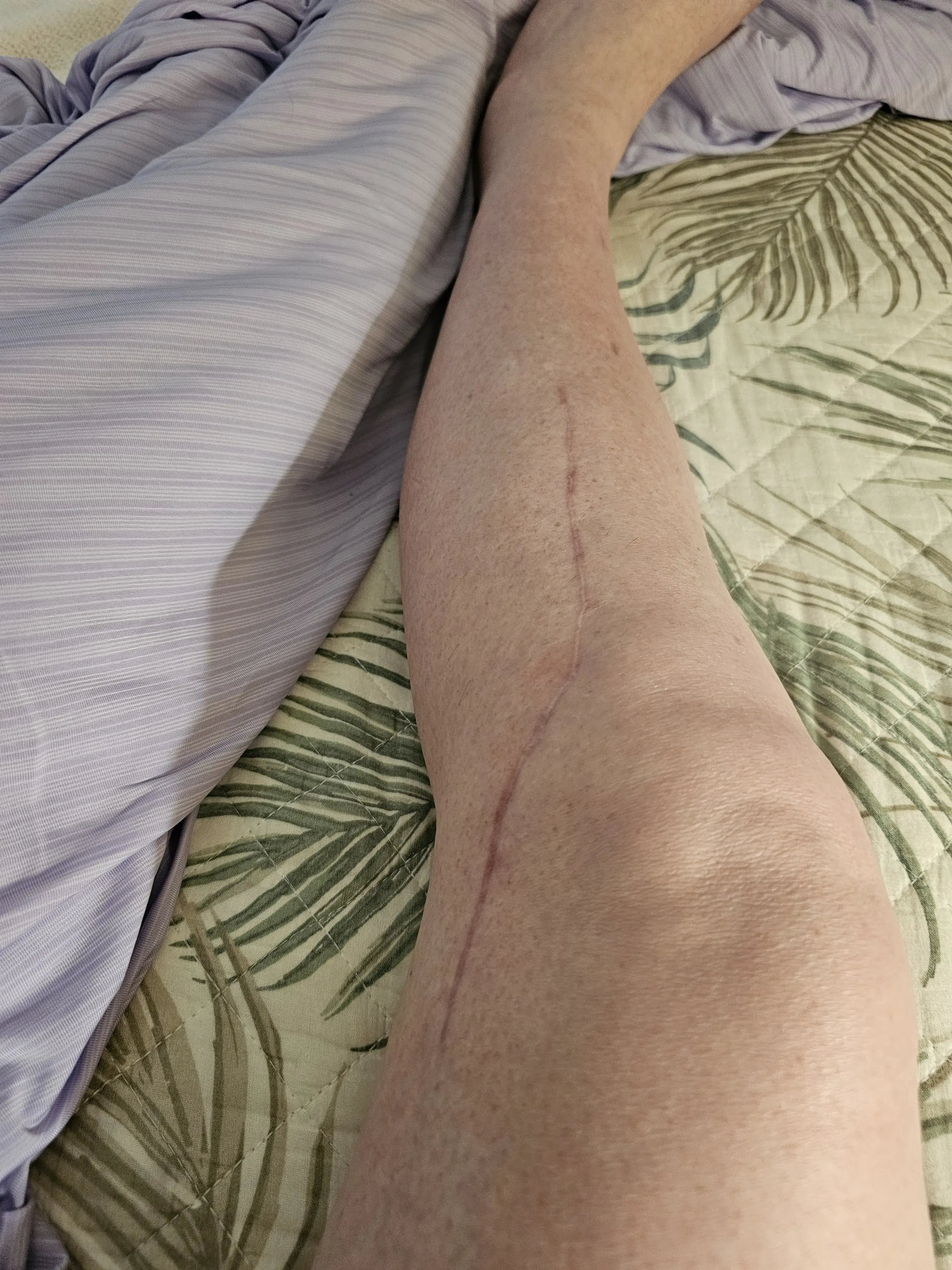 Jonathan Kletter, PA-C