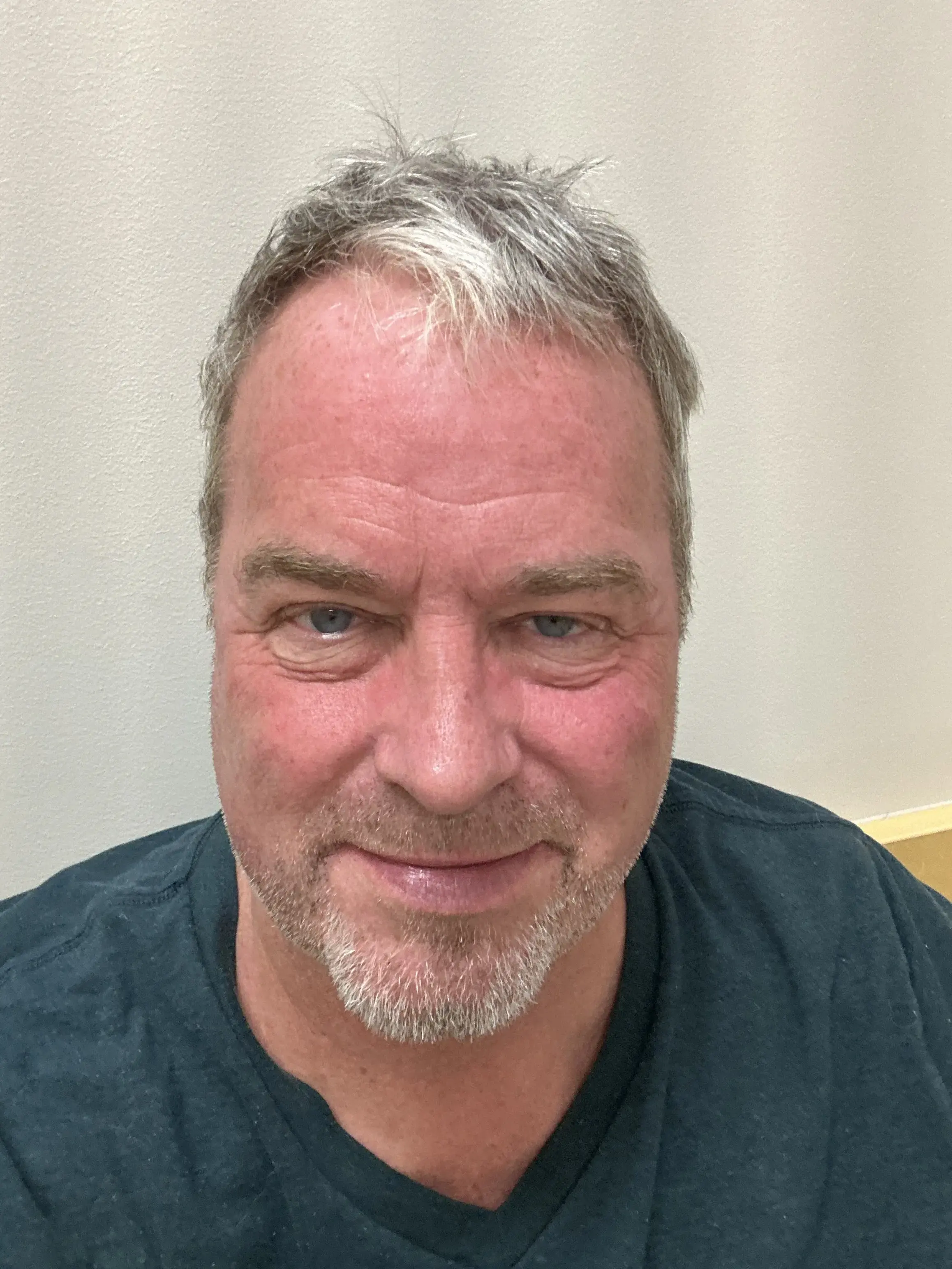 Joseph U. Barker, MD photo 3