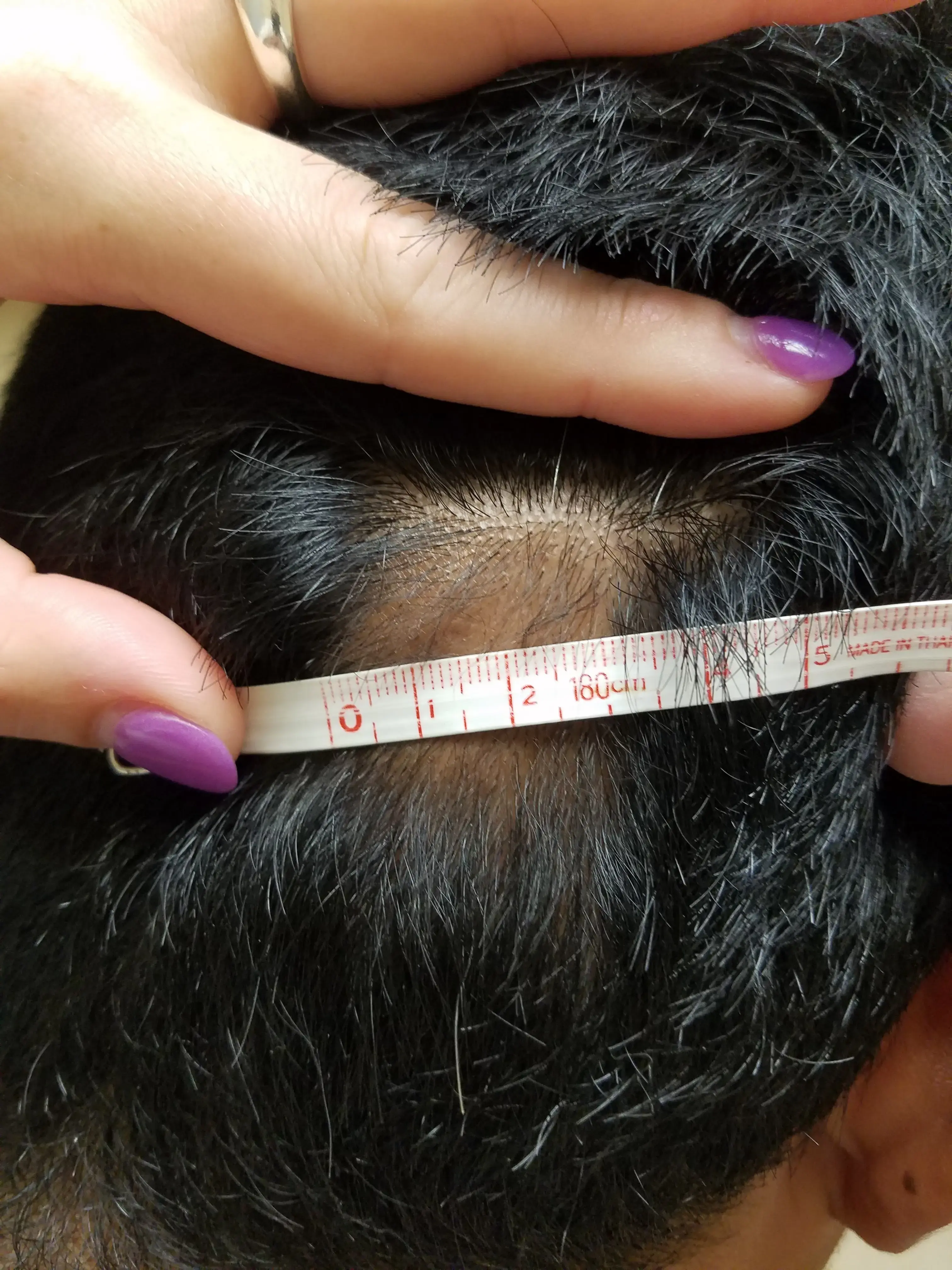 Just You Aesthetics photo 5