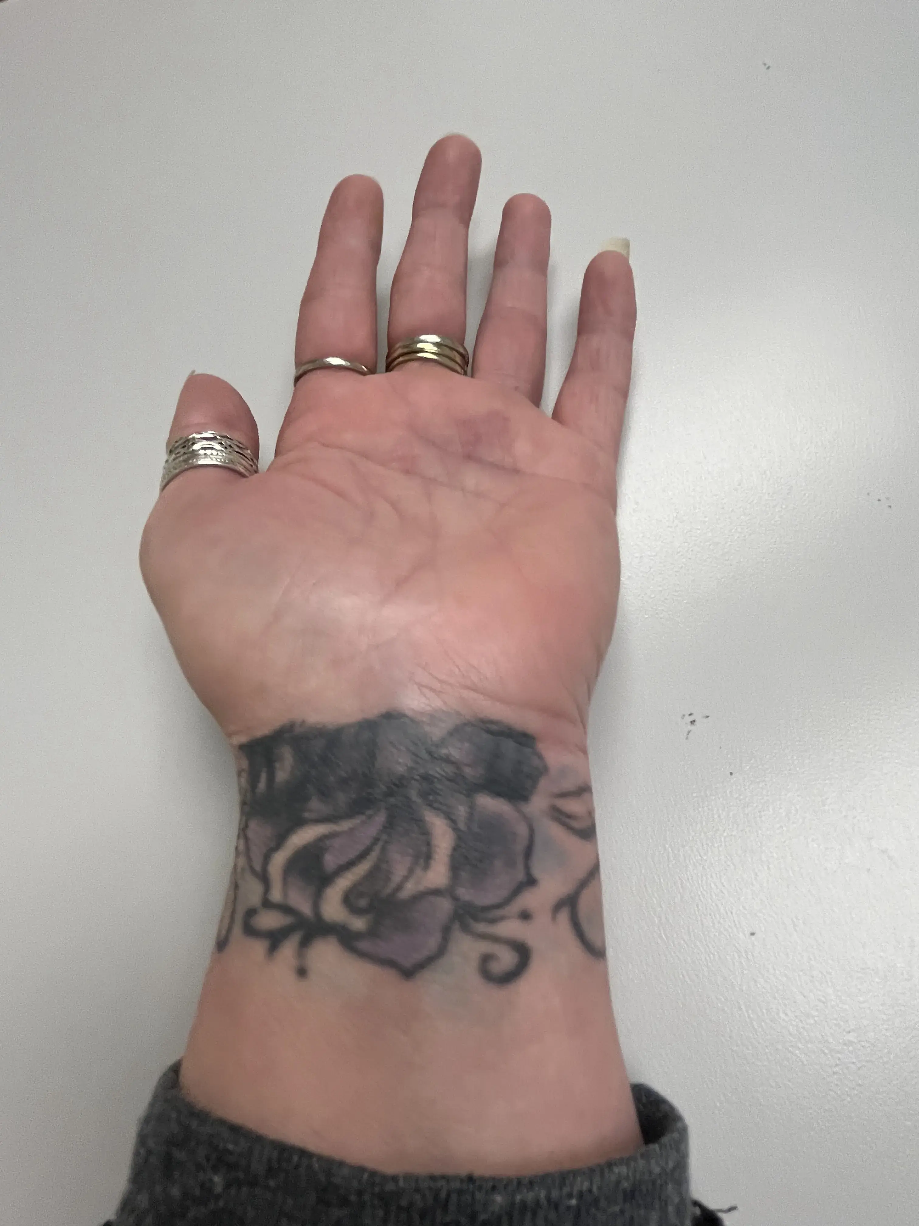 Longview Orthopedic Associates photo 4