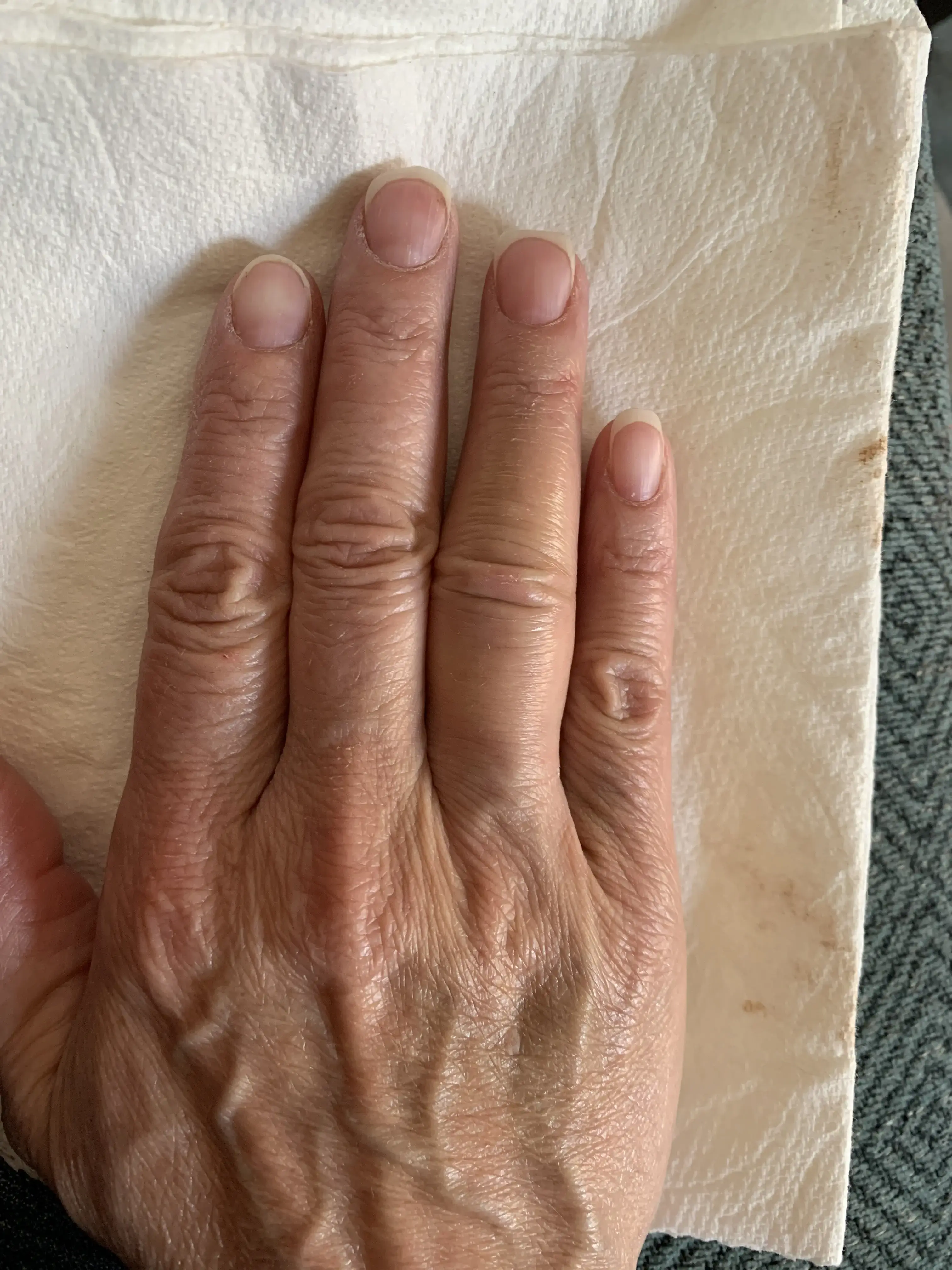 Los Angeles Orthopedic Surgery Specialist photo 5