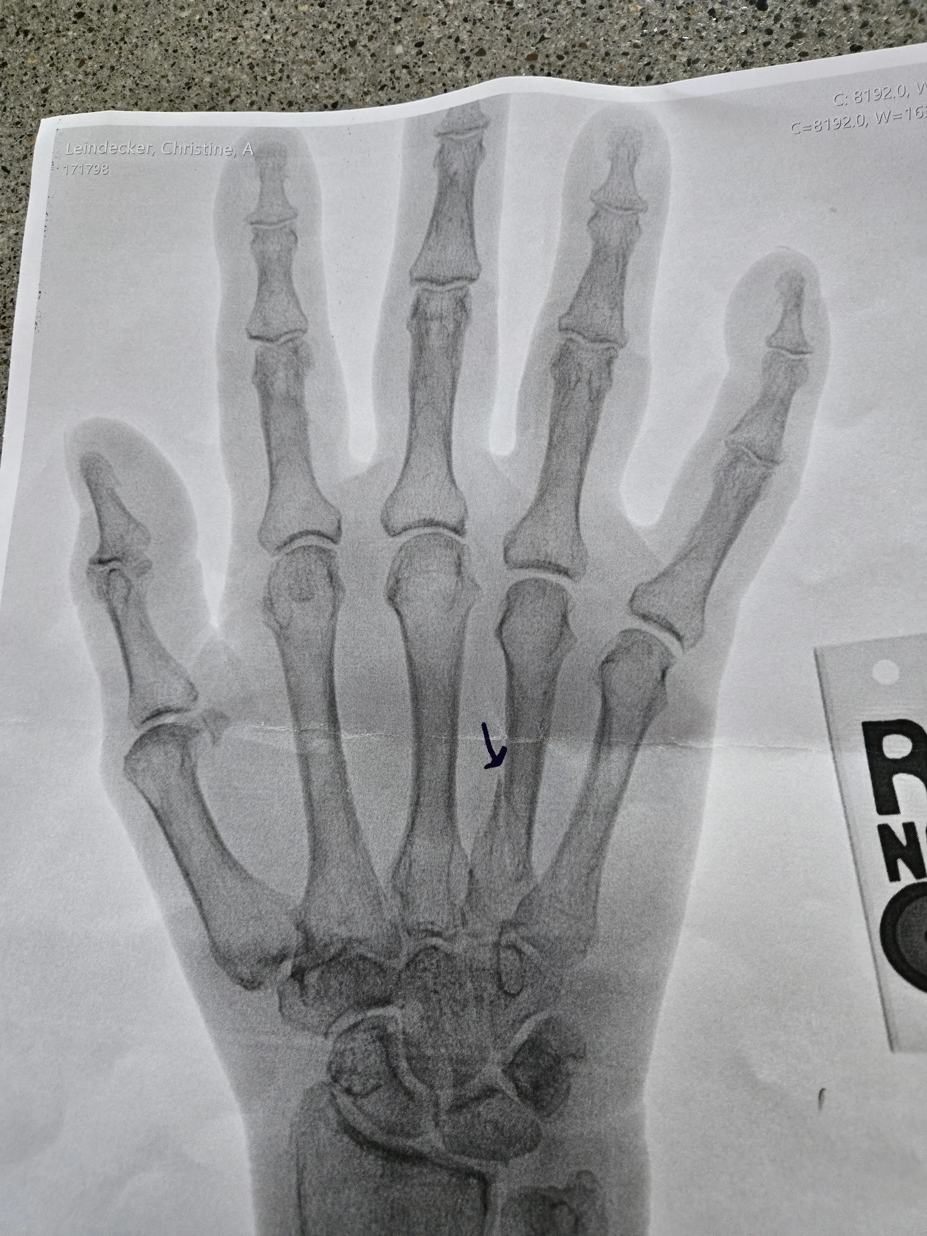 Mark Yaffe, MD photo 5