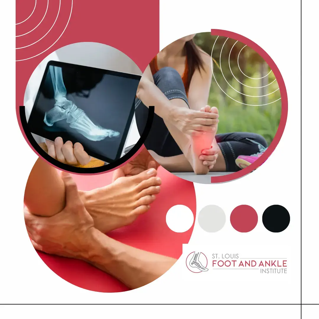 Meghan M. Arnold, DPM - St. Louis Foot and Ankle Institute photo 4