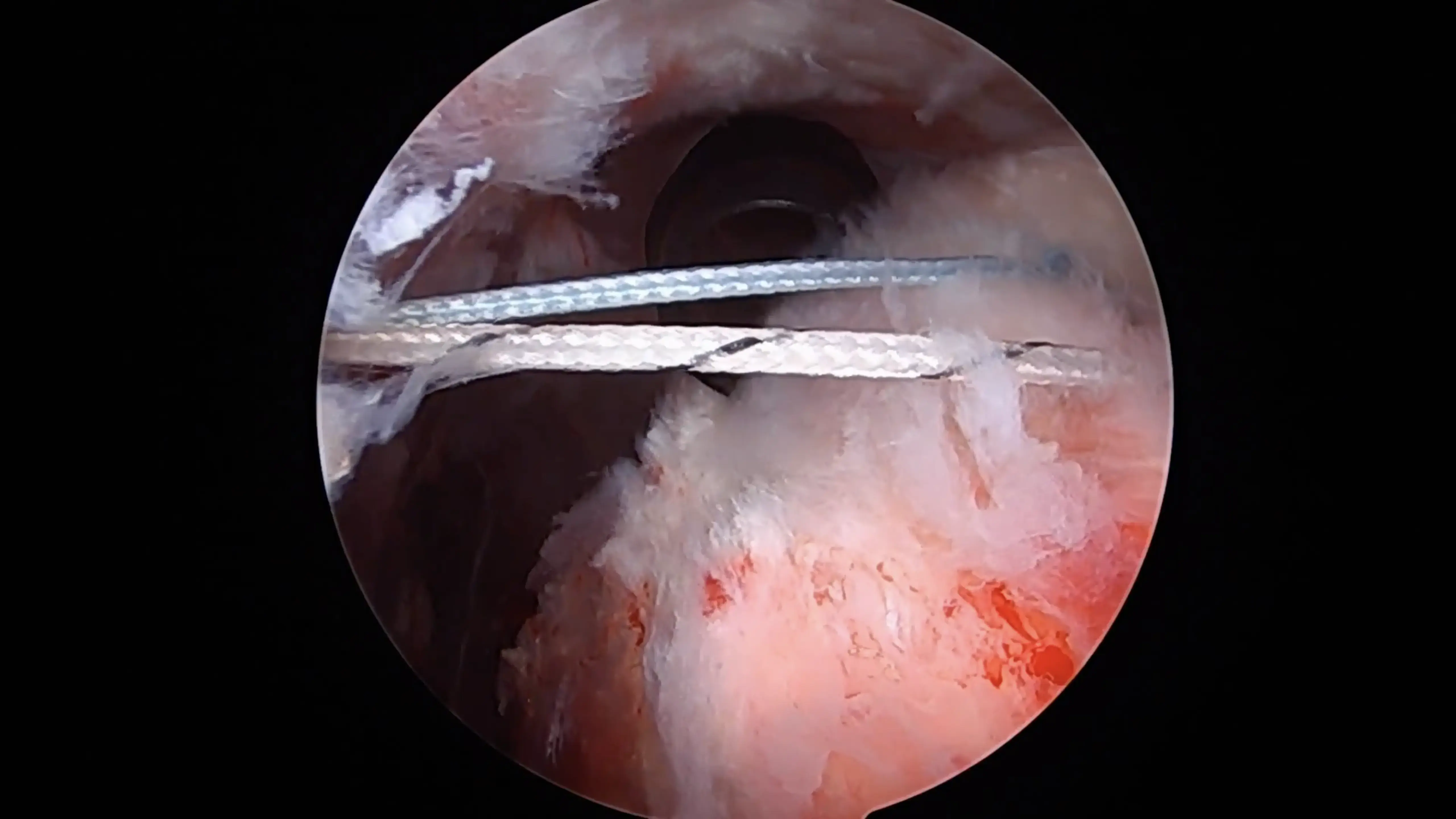 Mufaddal Gombera, MD - Orthopedic Sports Medicine Surgeon - Shoulder, Hip, and Knee photo 4