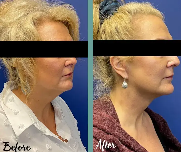 NEW YOU MEDICAL SPA photo 4