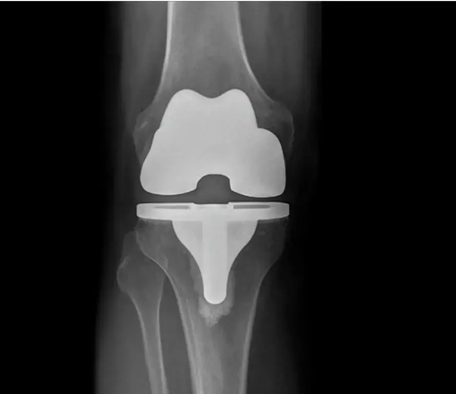 Orthopaedic Specialists, PLLC photo 3