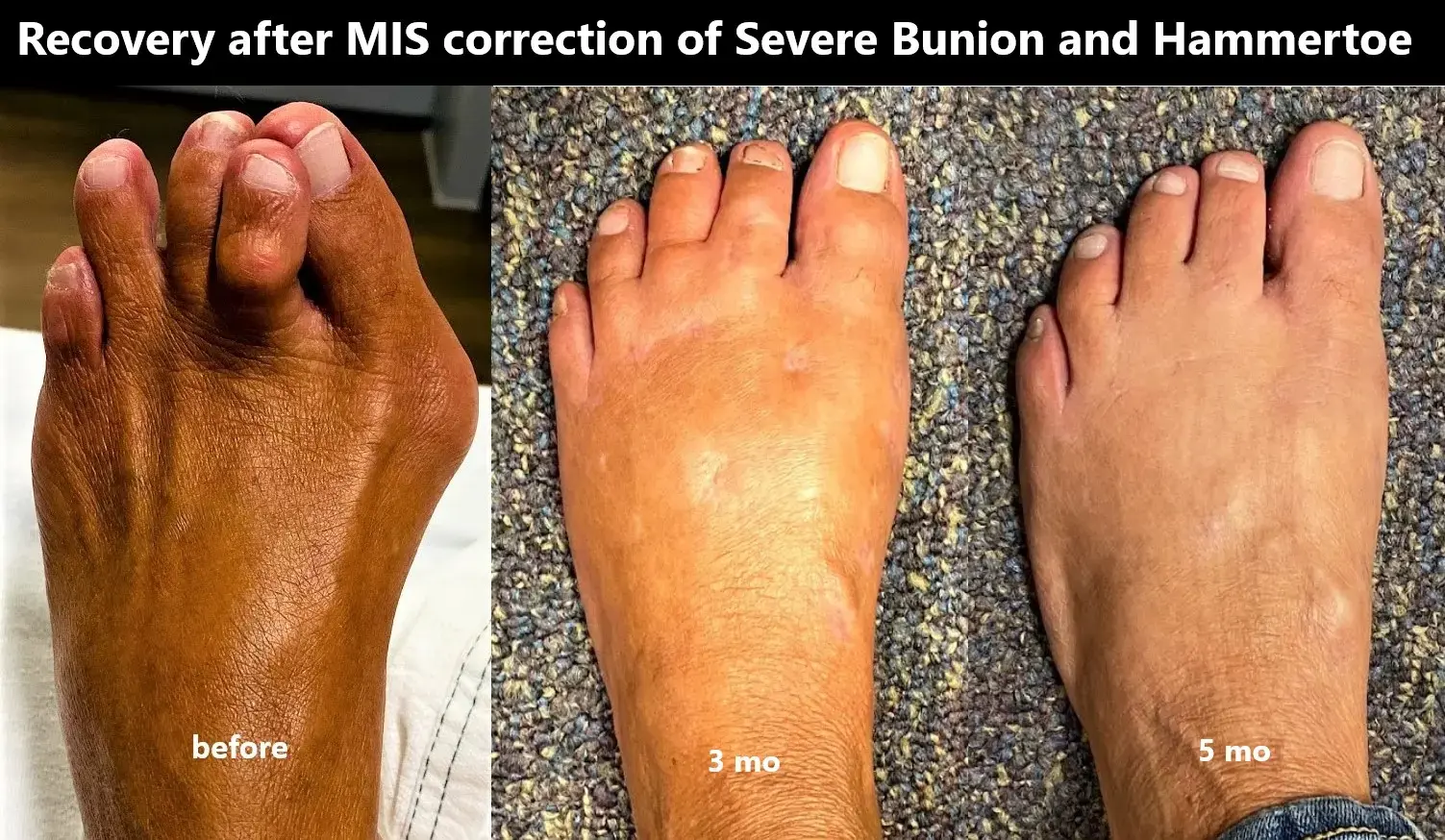 Phinit Phisitkul, MD