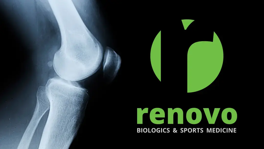 Renovo Biologics & Sports Medicine photo 3