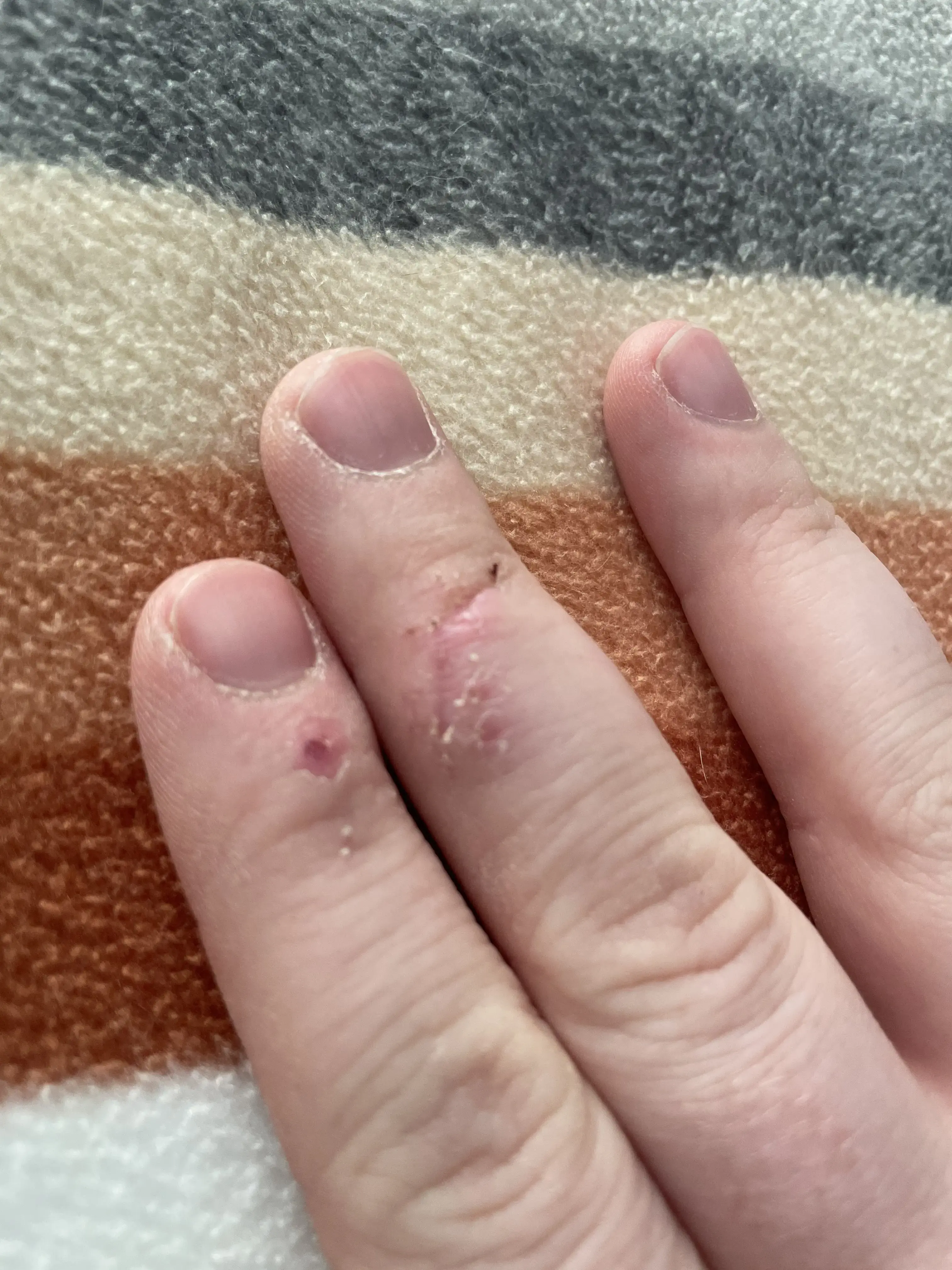 The Hand Center at Mid-America Orthopedics photo 3