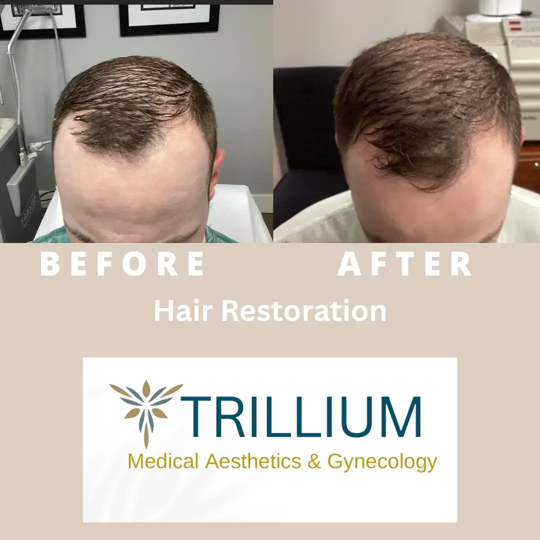 Trillium Medical Aesthetics & Gynecology: Michael McKay, MD photo 5