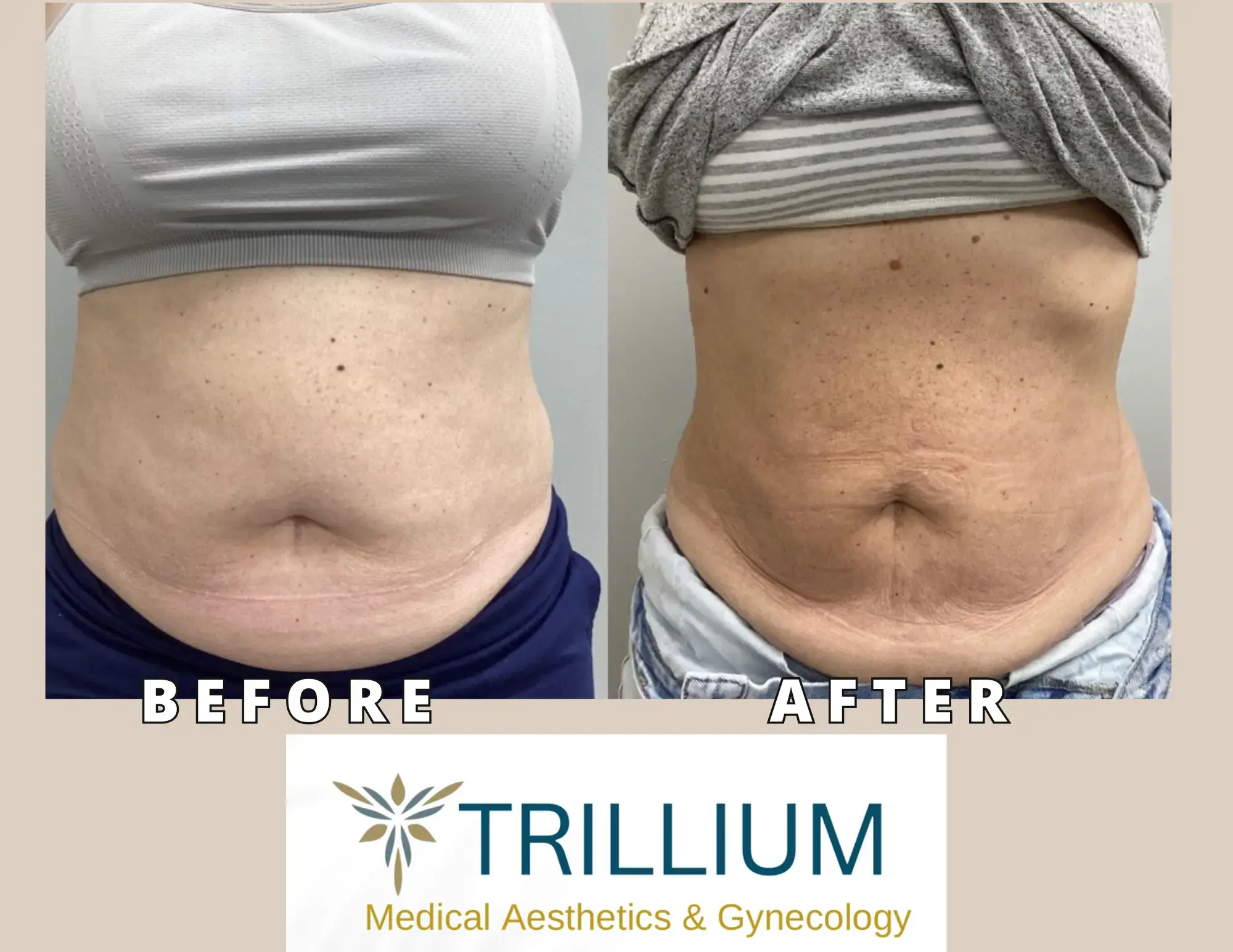 Trillium Medical Aesthetics & Gynecology: Michael McKay, MD photo 4