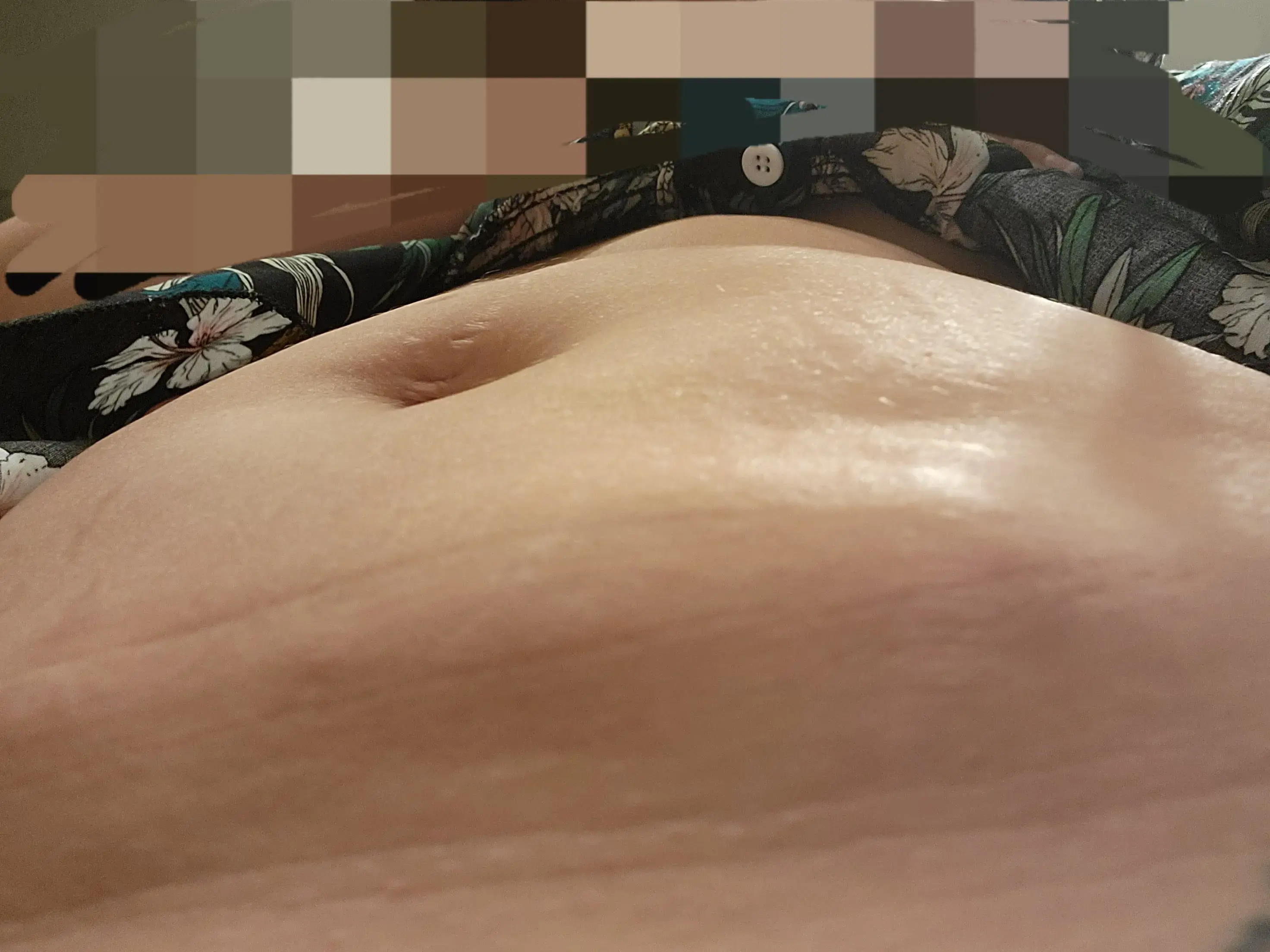 Trillium Medical Aesthetics & Gynecology: Michael McKay, MD photo 2