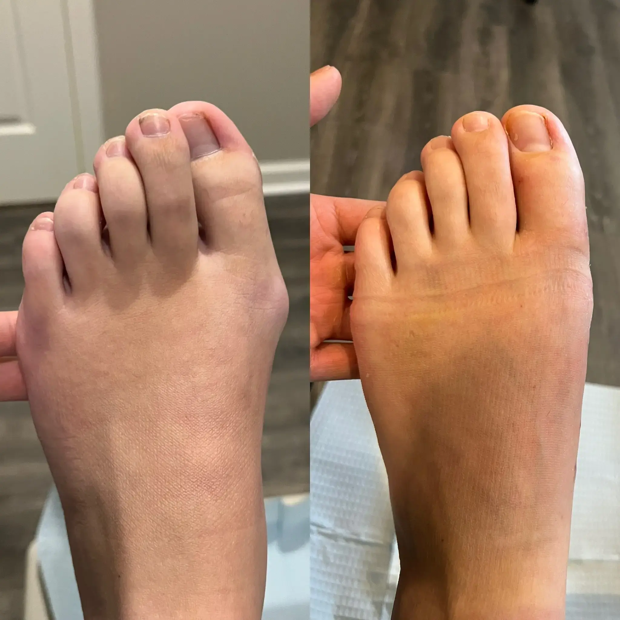 Vale Foot & Ankle Surgery, PLLC photo 5