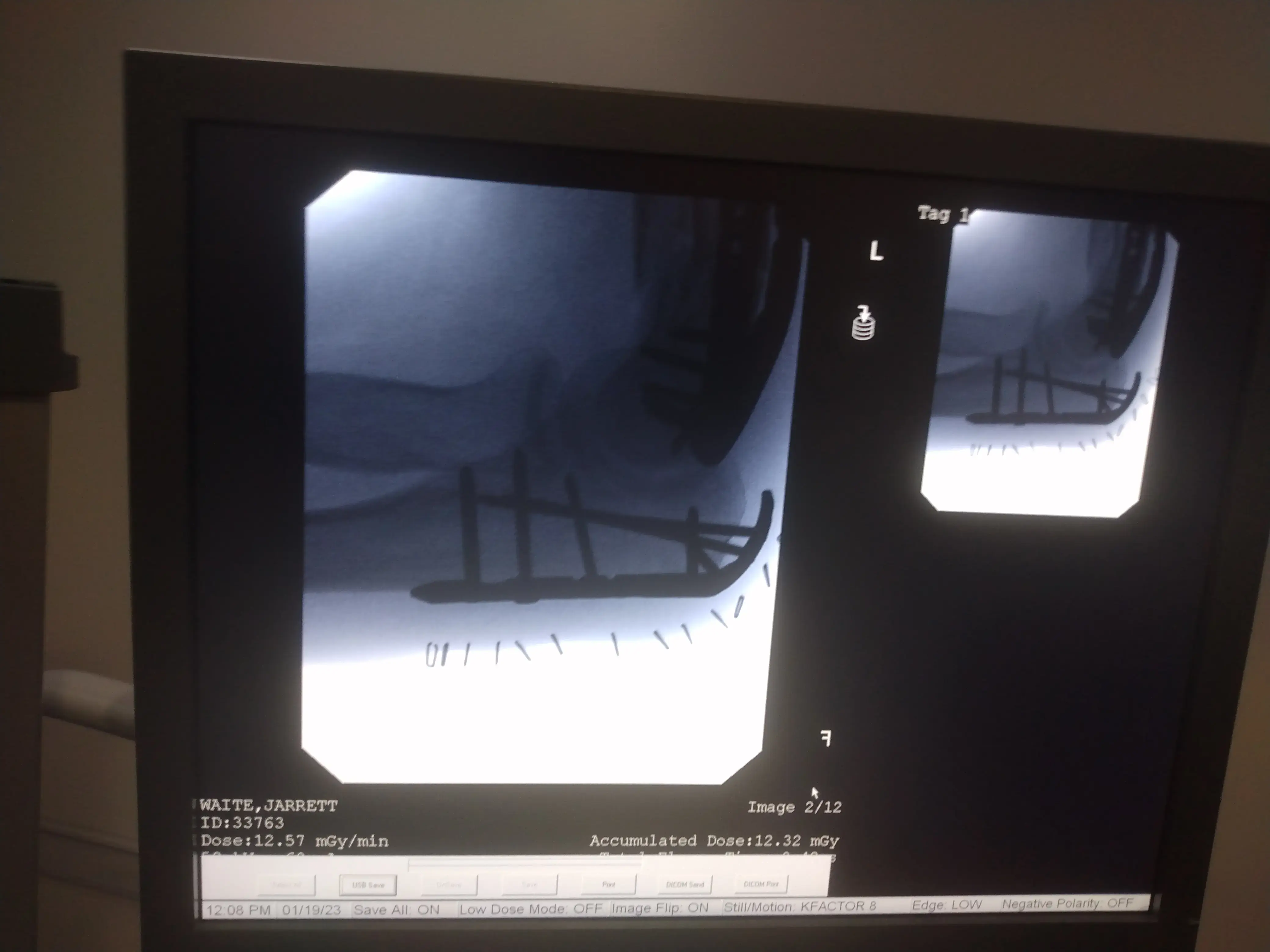 Vipul Patel MD FAAOS photo 4