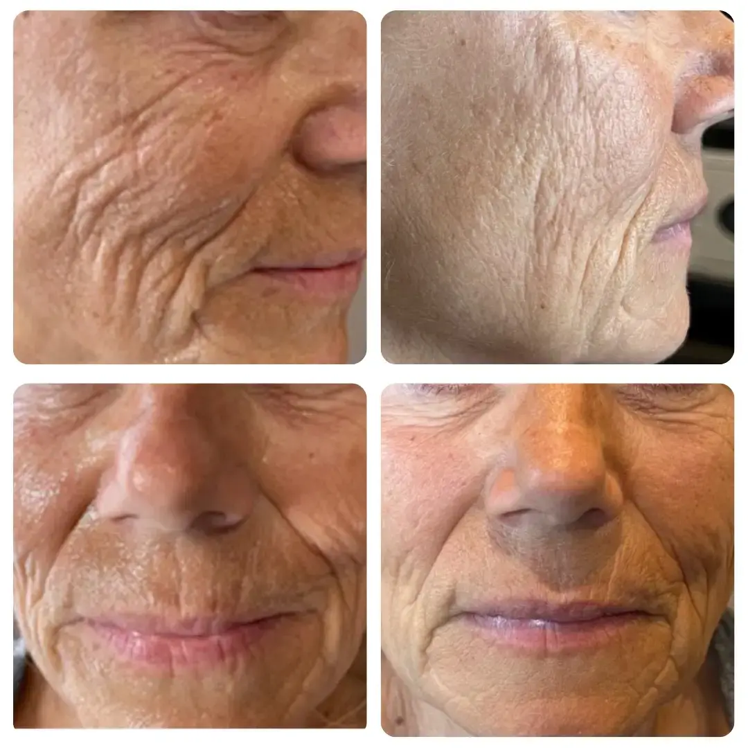 WHEN, LLC Wellness and Medical Aesthetics