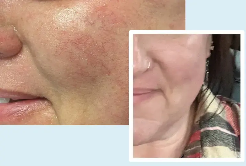 WHEN, LLC Wellness and Medical Aesthetics photo 5