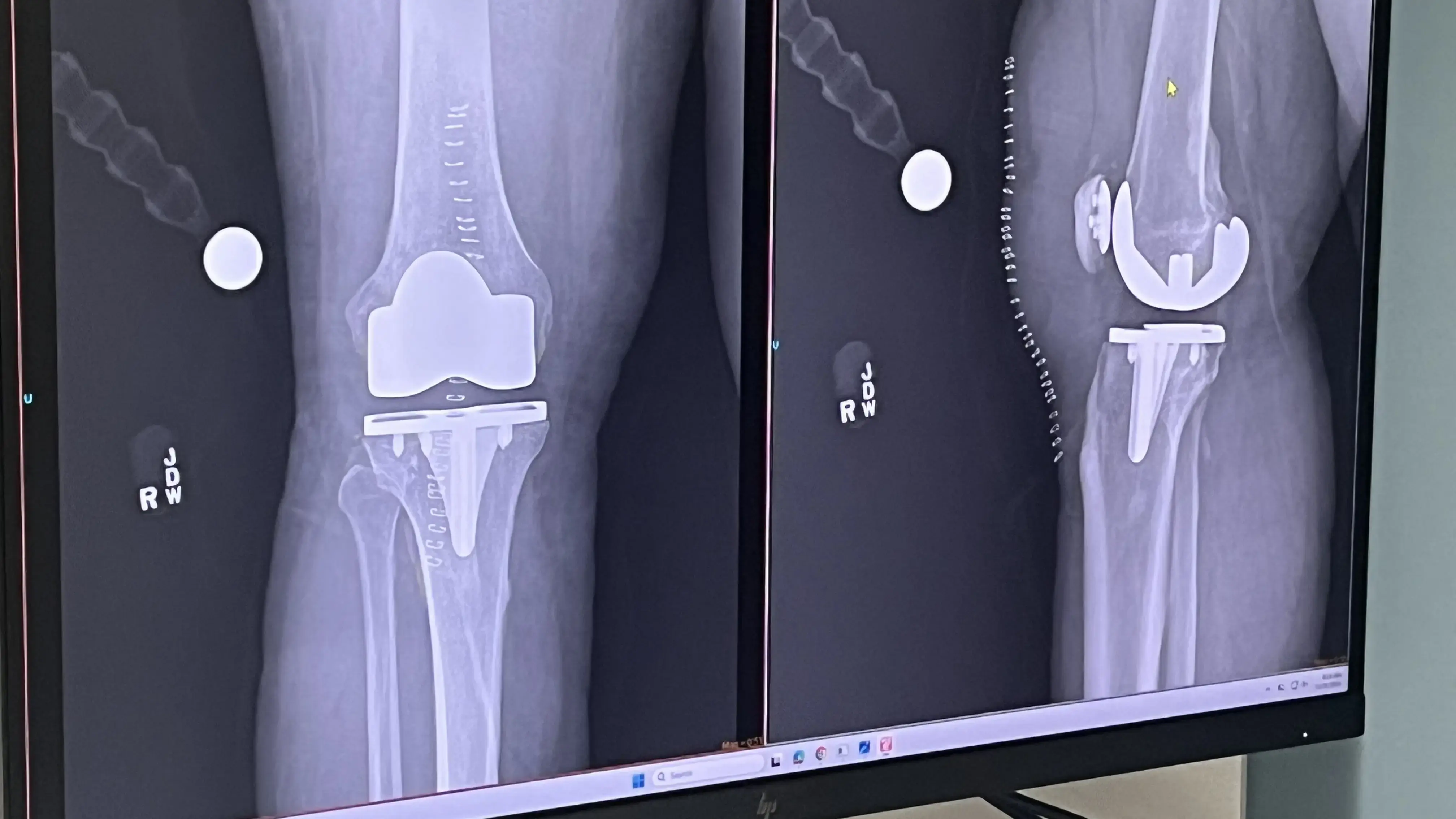 William F. Hefley M.D. photo 3